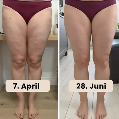 Slimora | Nahtlose Anti-Cellulite Sport-Leggings für Damen